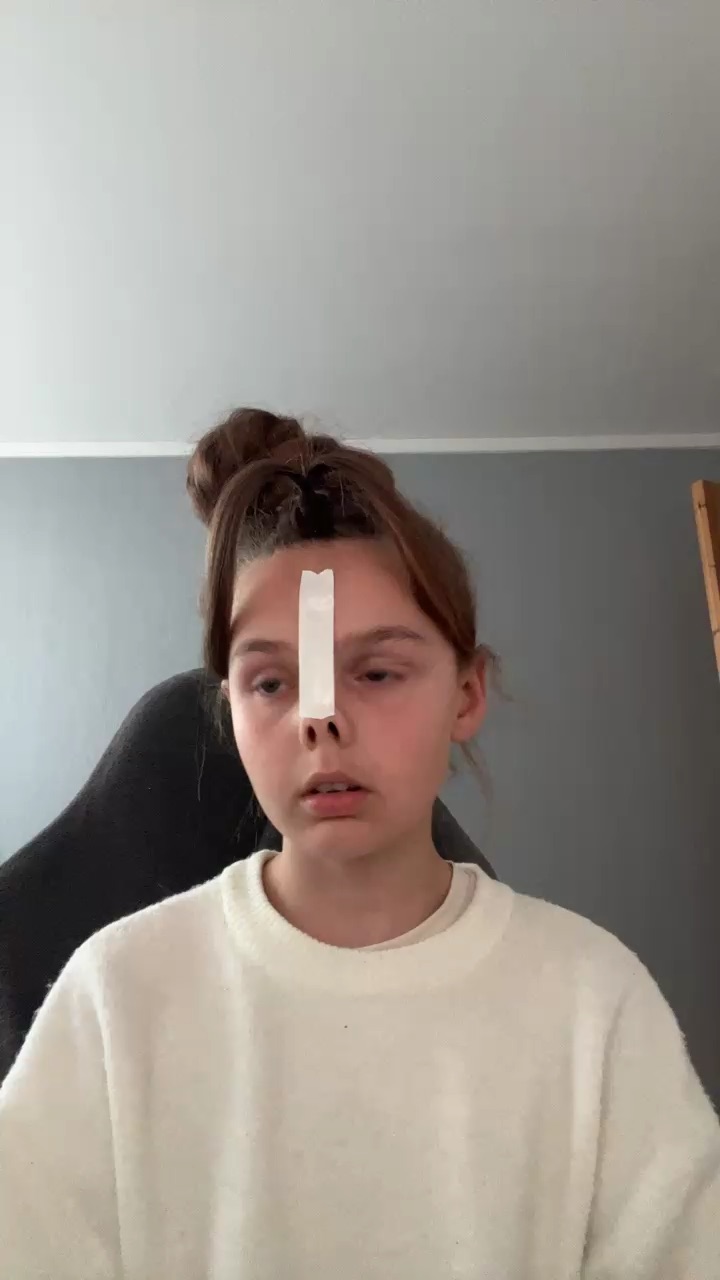 template