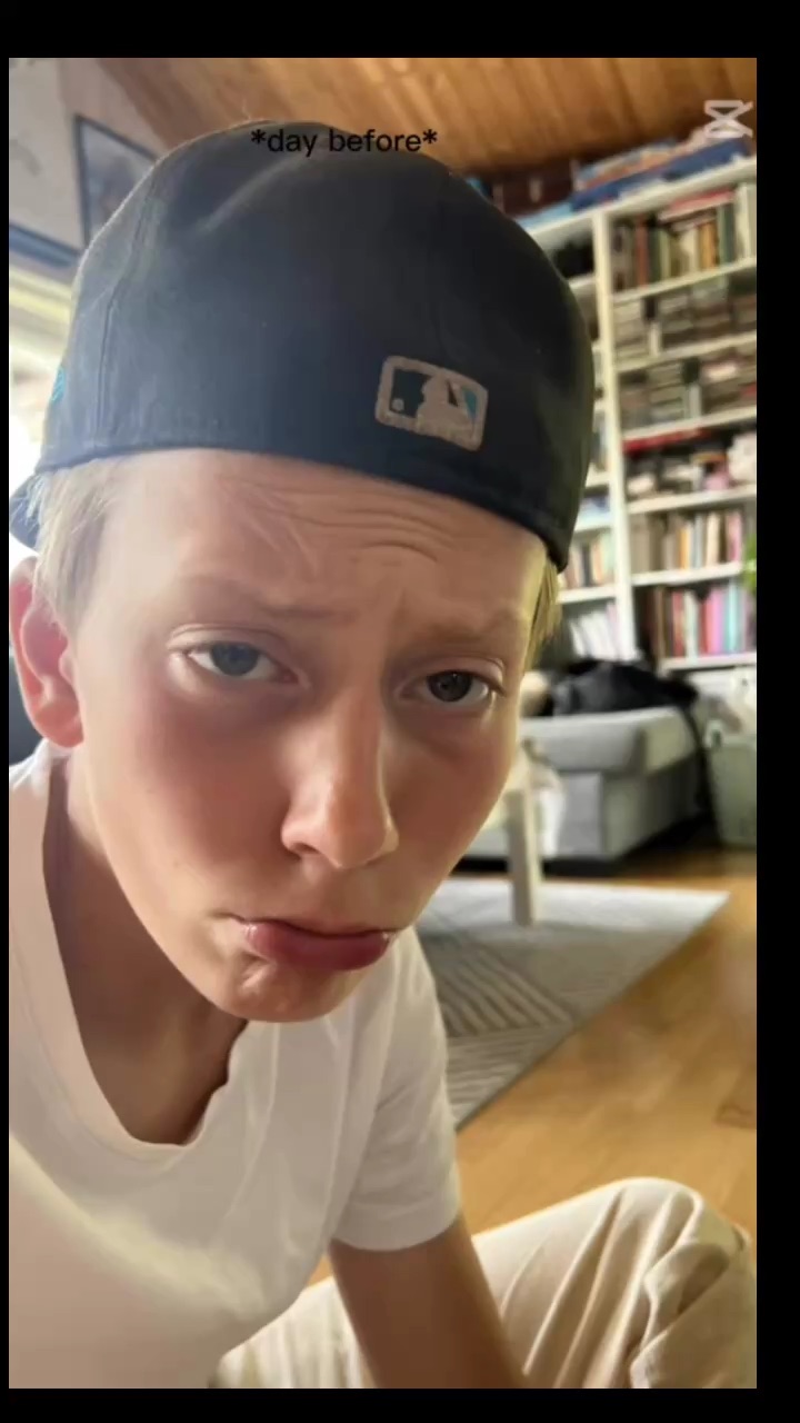 template